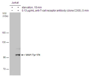 Anti-VAV1 (phospho Tyr174) antibody used in Western Blot (WB). GTX132786